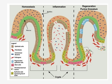 #Pomegranate Extract Affects #Gut #Biofilm Forming Bacteria &amp; Promotes #Intestinal #Mucosal #Healing 

mdpi.com/2072-6643/15/7…

<a href="/_atanas_/">Atanas G. Atanasov</a> <a href="/_INPST/">International Natural Product Sciences Taskforce</a> <a href="/ScienceCommuni2/">Science Communication</a> <a href="/DHPSP/">Digital Health and Patient Safety Platform</a> <a href="/deNutrients/">Jennifer Depew, RD</a> <a href="/Muzzpol/">Muzzpol</a> <a href="/club_gut/">The GUT CLUB</a> <a href="/ktguzz/">Katie Guzzetta 🌻</a> <a href="/seedhealth/">Seed Health</a> <a href="/Grimhood/">Mg2+ Papi, the BowTied Mg2+</a> <a href="/DrPalmquist/">DrRPalmquist</a> <a href="/BrianLenzkes/">Brian Lenzkes, MD</a> <a href="/DrRuscioDC/">Dr. Michael Ruscio, DC</a> <a href="/GMFHx/">GutMicrobiota Health</a>