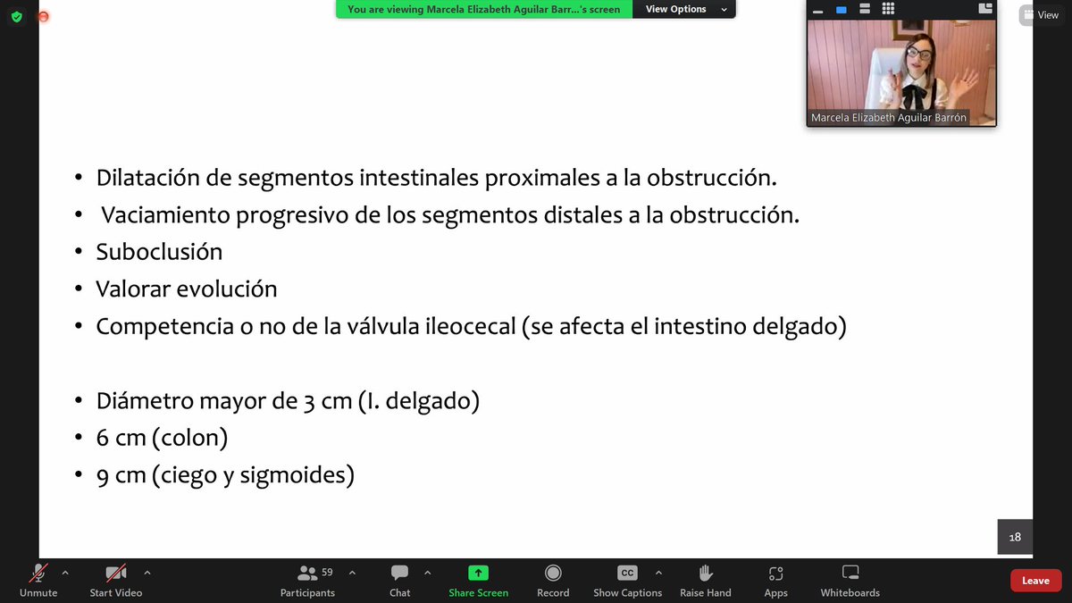 SaidDLCR's tweet photo. Limites normales de dilatación en intestino.
En delgado: 3cm
En colon: 6cm
Ciego-Sigmoides: 9cm
Para considerarse anomalo, por encima de dichos niveles.
#UpdateSMME #RadiografiaAbdomen https://t.co/cBYmvQApwl