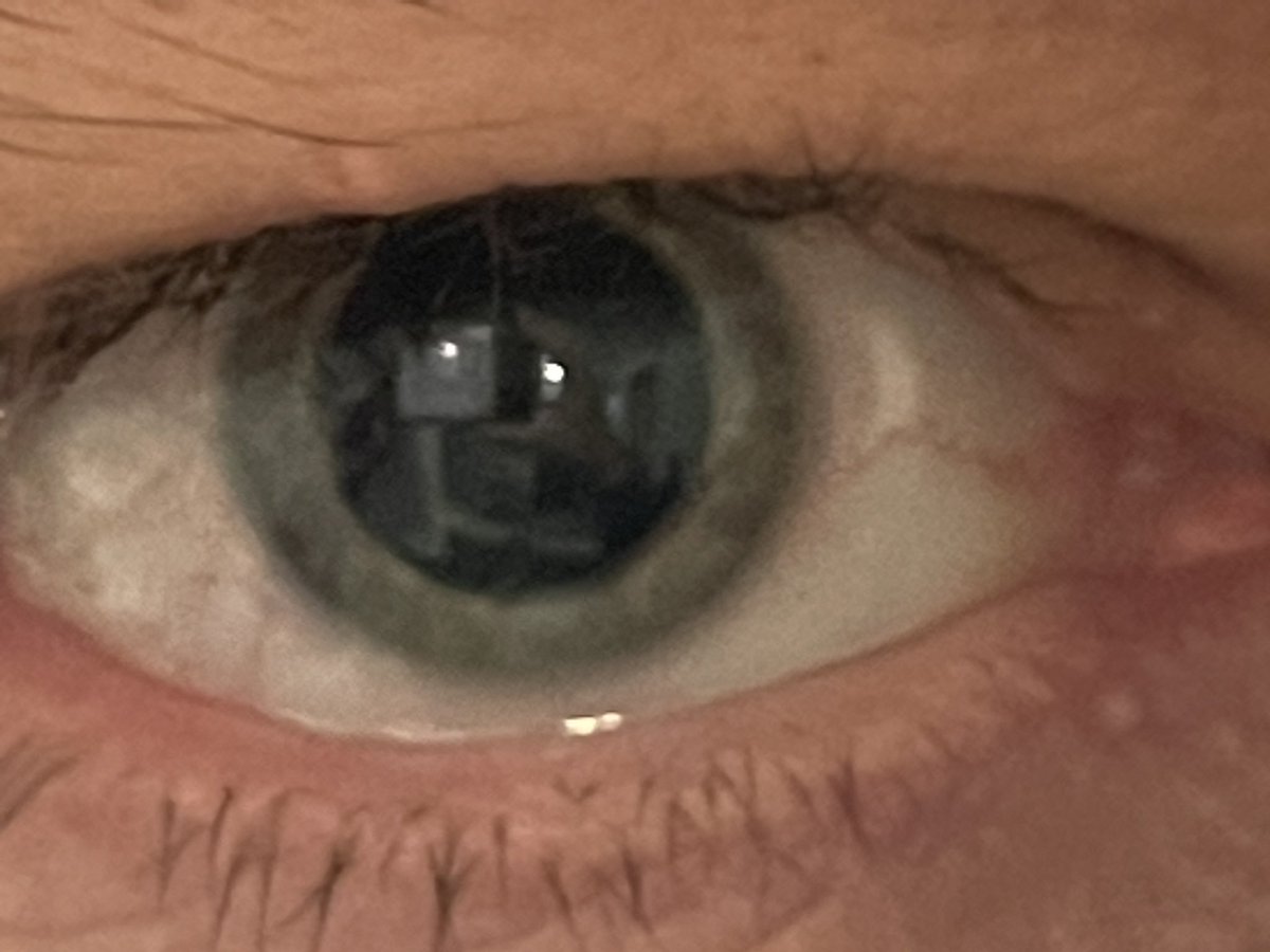 jamesaydelott's tweet photo. So, having an eye exam at 8:30am after being at work until 4:30am wasn’t the best way to start my Wednesday.   #SoSleepy #Dialation 👓 https://t.co/u6z8fYdCKj