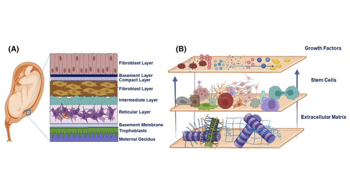 ArtifOrgans's tweet photo. #Fabrication and multiscale modeling of #Polycaprolactone/amniotic membrane electrospun #Nanofiber scaffolds for #WoundHealing
👉https://t.co/s5mBBCITHr
@UnivOfTehran🇮🇷| #KeratogenicDifferentiation https://t.co/4wO0LeKfvO