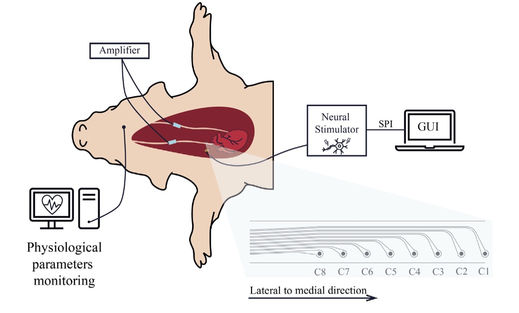 Happy to share our new paper on 'Cardiovascular Response to #Intraneural Right Vagus #Nerve #Stimulation in Adult Minipigs' for the exploitation of vagus nerve stimulation for #bioelectronics #medicine #cardiovascular #disease 
@NeuHeartH2020 
sciencedirect.com/science/articl…