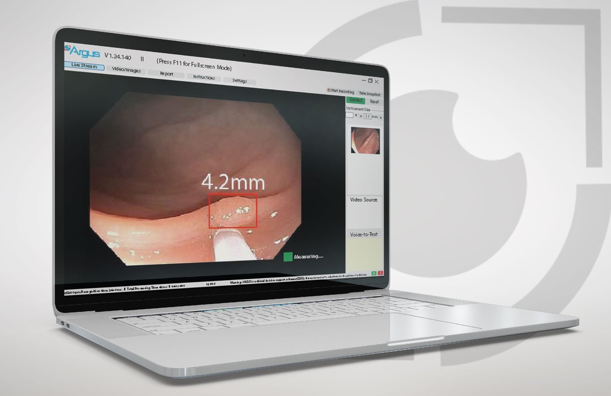 EndosoftWorld's tweet photo. Argus® CAPs standardizes the sizing of polyps in real-time. Standardized sizing allows clinicians to set appropriate patient surveillance intervals. Make sure to see Argus in live action at @Di , Booth #4315!
#GI #Gastro #HereforDDW #AI #CAPs #PolypSizing #DDW2023 https://t.co/0kB7kVzrJG