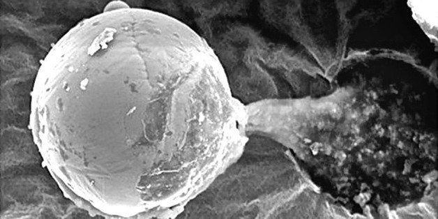 GenomicSETI's tweet photo. A Directed Panspermia Seed?

Do we have any physical evidence, other than DNA centred arguments, that strengthens the directed panspermia hypothesis?

Well, maybe...

In 2015, the British astrobiologist, Milton Wainwright, found a microscopic sphere made out of titanium and vanadium with a “gooey” biological liquid oozing from its center. 

The sphere had impacted a collection mechanism of a scientific balloon that was collecting samples from the stratosphere, over 25 km from the surface of the planet. 

It impacted at great speed leaving a crater, suggesting arrival from outer space.

While it remains mysterious, this artefact could fit with advanced ET sending out artificial seeds to propagate life.