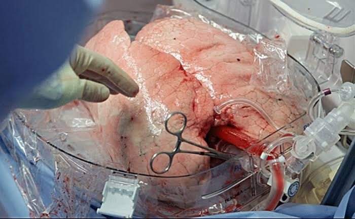 DrFoziakeerio's tweet photo. Congratulations to people of Pakistan 
Congratulations Dr. Raheem Bux Bhatti @DrRahimBuxBhat2 

Gims , is all set to start lungs transplant very soon in few weeks. Insha Allah 

The state of art building and lung transplant unit is established

 #Gimslungtransplantunit https://t.co/HpCQS7eMgb