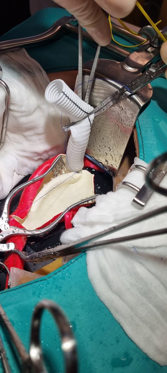 CPH Vascular Research Unit (@vascularcph) on Twitter photo ENHANCE OPEN Collaboration between CAMES, Dept Vasc Surg in Copenhagen and EDVS. 12 eager international trainiees learning open AAA by international experts on state of the art open sims. what not to like?? <a href="/VascularCph/">CPH Vascular Research Unit</a> <a href="/ESVSmembership/">ESVS</a> <a href="/CamesResearch/">CAMES_Research</a> ENHANCE OPEN Collaboration between CAMES, Dept Vasc Surg in Copenhagen and EDVS. 12 eager international trainiees learning open AAA by international experts on state of the art open sims. what not to like?? <a href="/VascularCph/">CPH Vascular Research Unit</a> <a href="/ESVSmembership/">ESVS</a> <a href="/CamesResearch/">CAMES_Research</a>