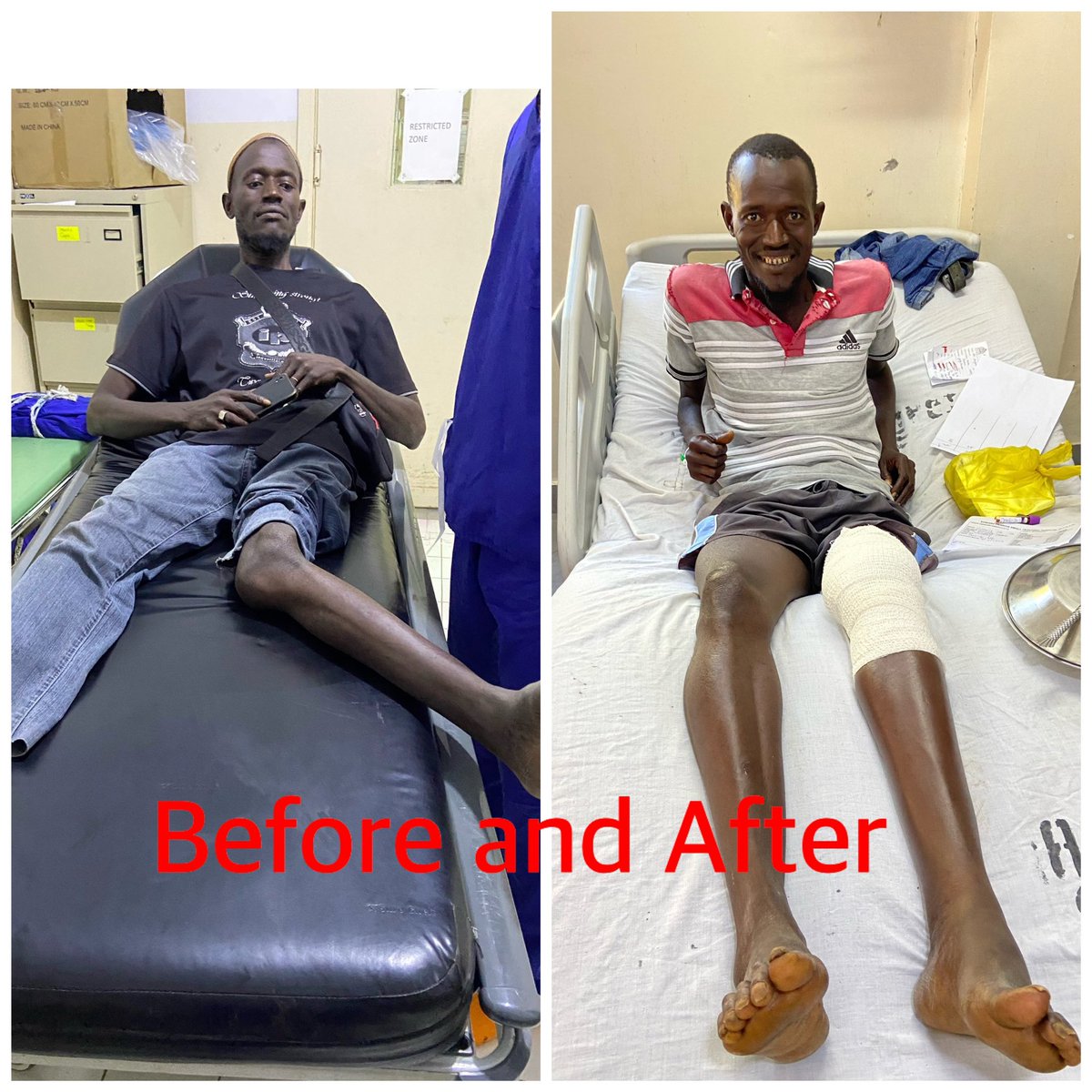 TheAlkambaTimes's tweet image. Former footballer receives incredible life-changing knee surgery from Gam Med Team!  

Restoring lost hope, A Gambian man has received an incredible life-changing operation on his knee after a knee deformity he had been battling for years.  A team of medical professionals treated…