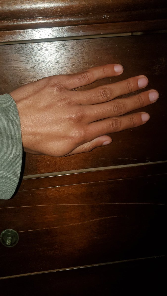 Dumb Wolf Ely tweet media