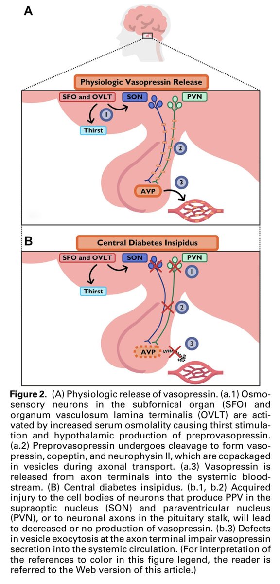 JonathanNefro's tweet photo. Que exquisita forma de manejar el agua🥹

#ISNyoung
Adv in Kidney Disease and Health 2023
https://t.co/NLkj12QHRN https://t.co/pSPU5fgJLi