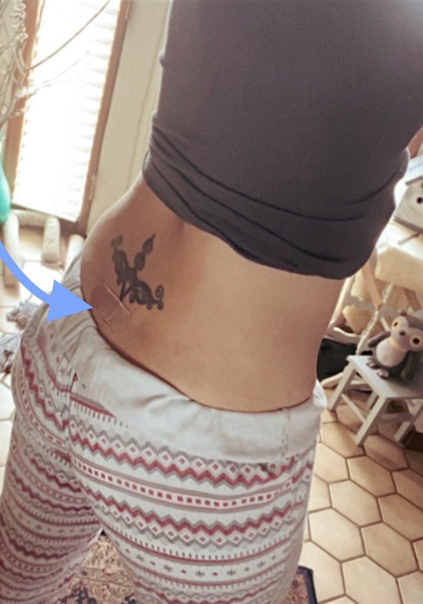 Rynncoll's tweet image. When 27 yrs later your tramp stamp is less of a regret &amp;amp; more so the beacon that leads the huge epidural needle that will hopefully assists in alleviating your spinal pain. #spinalpain #epidural #trampstamp