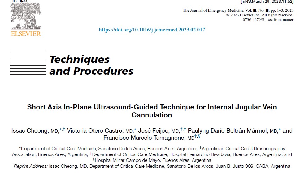 Issac80's tweet photo. Short Axis In-Plane Ultrasound-Guided Technique for Internal Jugular Vein Cannulation

Journal of Emergency Medicine

https://t.co/A30f3ImFCg

50 days' free access link: https://t.co/OoyKBmlkNd

@vickyoteroc  @BeltranPaulyng  @panchopocus @ASARUC1 

#POCUS https://t.co/UeFDOXsbsp