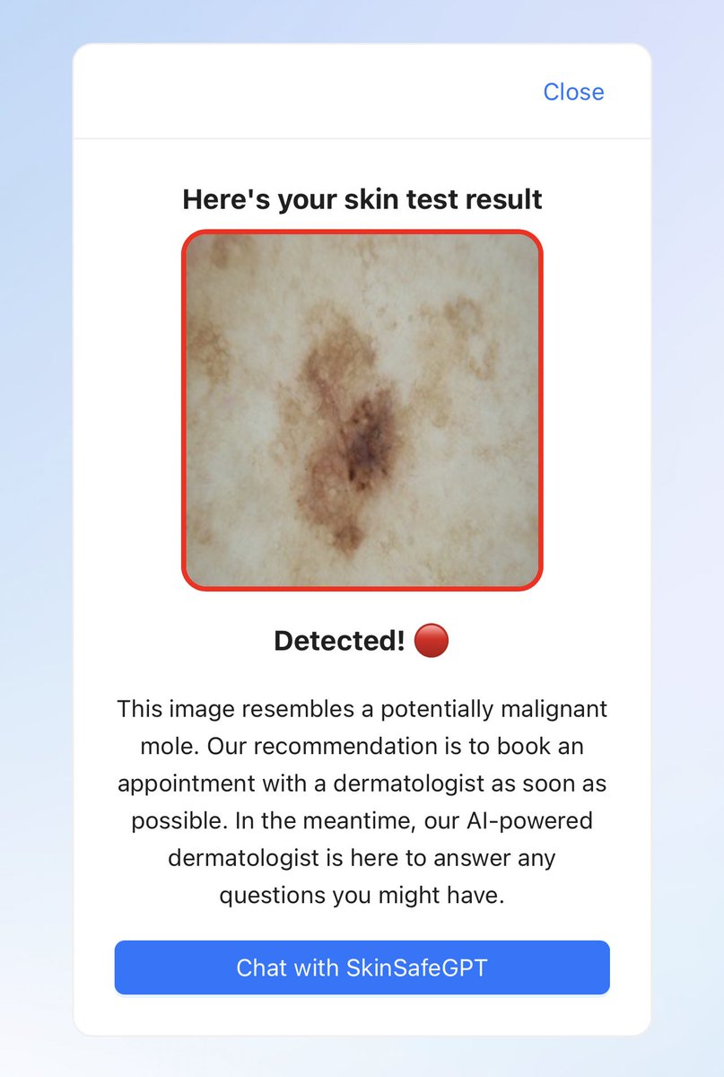 AviSchiffmann's tweet image. Worried about skin cancer? 🌞

SkinGuardAI, developed during our &quot;AI for Good&quot; hackathon, uses computer vision to detect dangerous moles and aid in early detection! 

Try it now: skinguardai.com