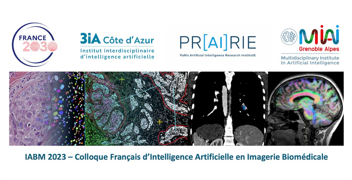 We are a proud sponsor of IABM 2023 in Paris March 30-31.
During the Symposium, Antoine Iannessi, Senior Medical Director at Median Technologies, will talk about "AI-Powered Medical Imaging to Accelerate Drug Development" More info about IABM 2023 here: lnkd.in/dYg7xYPN