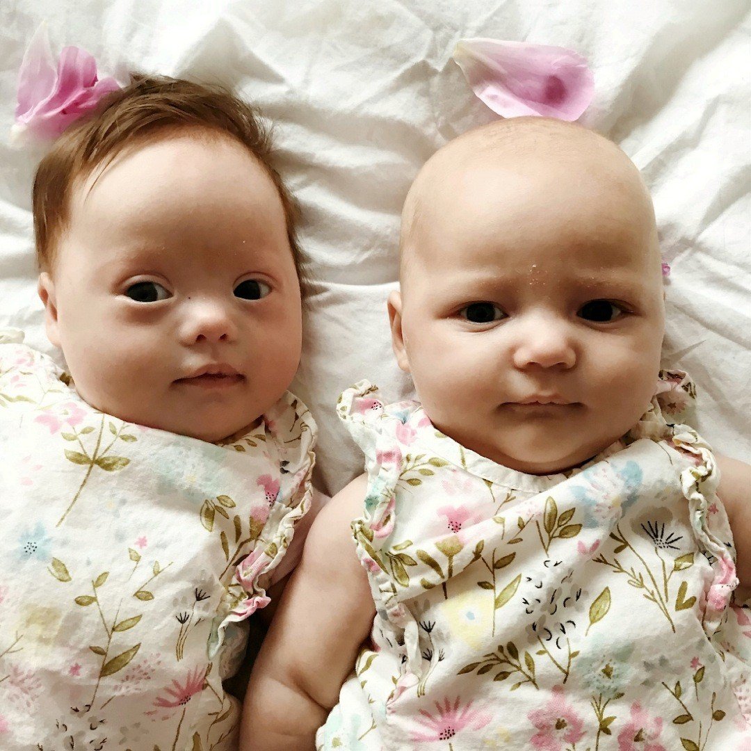 'Despite the fact they’re not identical and Harper has Down’s syndrome [...]. The bond they share as twins is like nothing else and I can’t wait to continue to watch them both grow.' 

Read more on the one-in-a-million twins:
theepochtimes.com/one-in-a-milli…