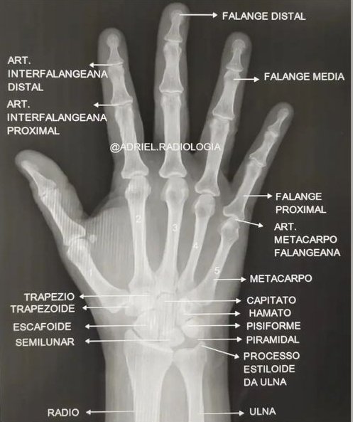 AnatomiaEl7499's tweet photo. Anatomía radiologica de la mano. https://t.co/EVusNRw6mq
