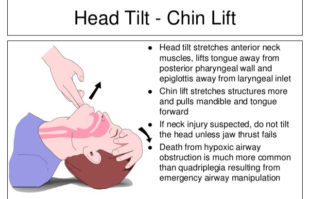 Jaw Thrust Maneuver Animation View An Animation 47 OFF jaw-thrust-maneuver-animation-view-an-animation-47-off