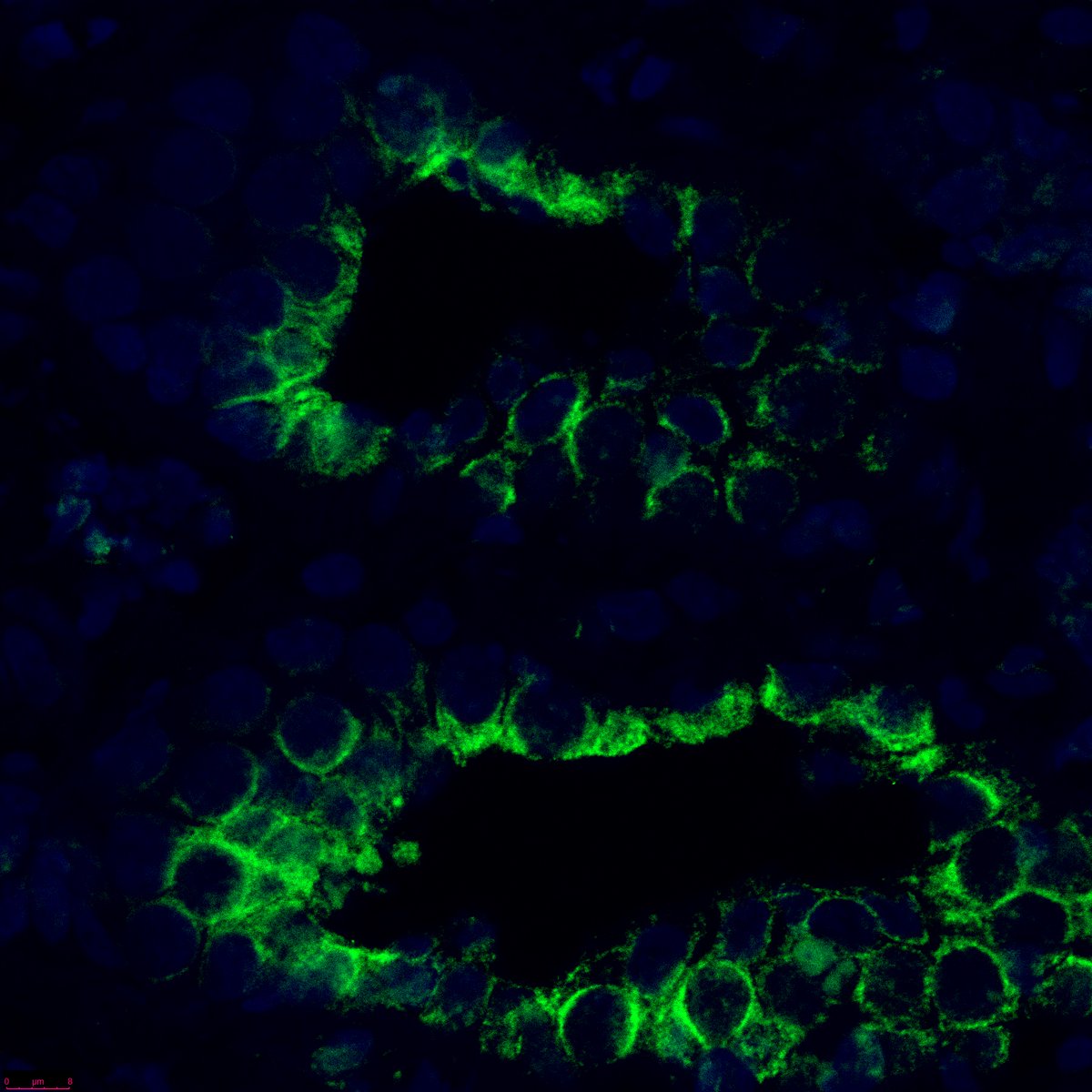 Guillaume Hoareau, DVM, PhD, FCCM (@reanimationvet) on Twitter photo Very excited by our recent bench findings regarding ischemia-reperfusion mitigation! Getting great images of IL-6 expression in the kidney Very excited by our recent bench findings regarding ischemia-reperfusion mitigation! Getting great images of IL-6 expression in the kidney