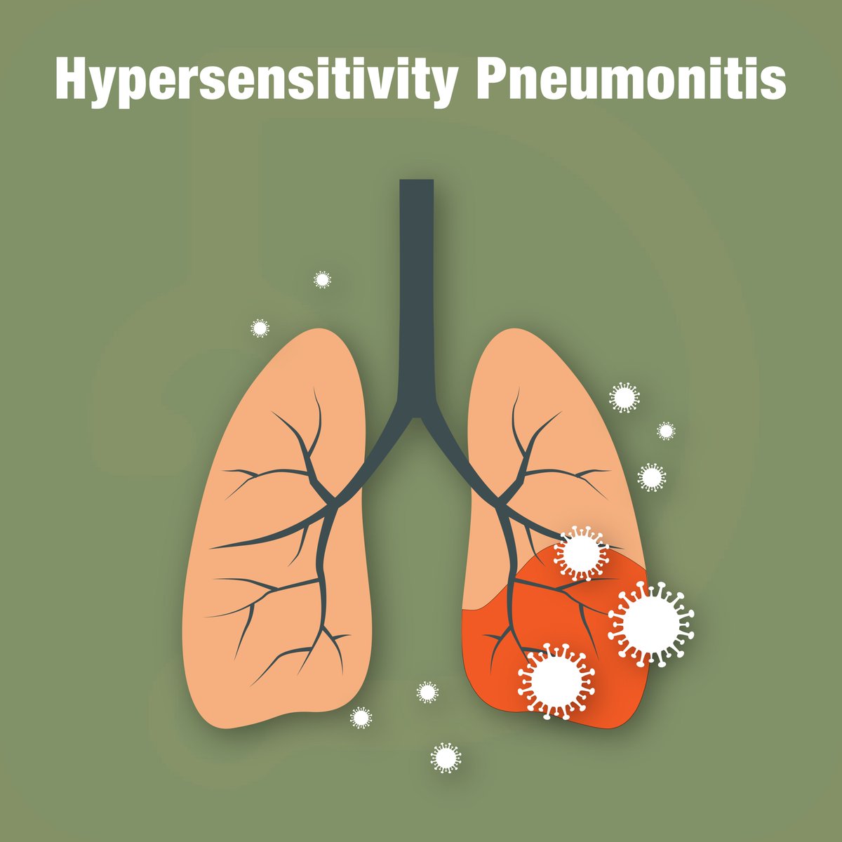 Docsteth1's tweet photo. Hypersensitivity pneumonitis is a rare lung disease that affects a small percentage of people.
To know more about Hypersensitivity Pneumonitis click on the link
🔗https://t.co/Nsx38wx6EP
#Hypersensitivitypneumonitis #clinic #MedEd #internalmedicine #Docsteth #DocstethPost https://t.co/lONLoXMIMf