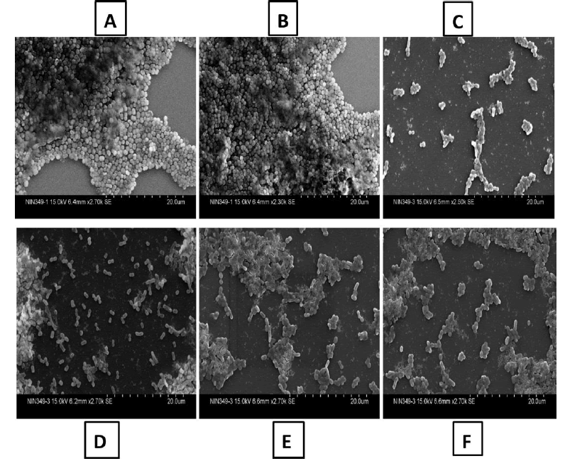 ijmrhs's tweet photo. ✨We are so pleased to share a hot paper from Dr. Venkataraman Srithara 🤗

📑#Targeting #Multidrug #Resistant A. Baumannii to #Evaluate Anti-Biofilm and Anti-Quorum #Sensing Potential of Some #Compounds

Read from here!🔍: https://t.co/9vmoUsRZbB

#IJMRHS #Research #Journal https://t.co/9f9atmYjct