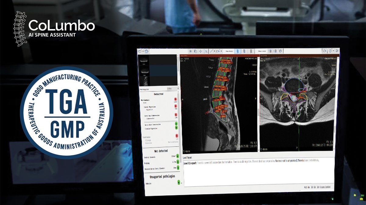 We are proud to announce that after an extensive application process, CoLumbo becomes the world’s first lumbar spine AI software for MRI modality to receive an Australian Register of Therapeutic Goods Administration. (TGA)