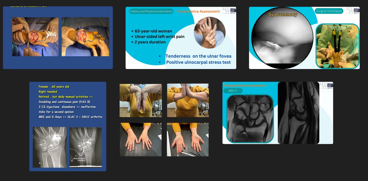Halimatoune's tweet photo. International Wrist centers symposium .
Next Saturday !
Link to register >>>>
https://t.co/6jekjOCtt2 https://t.co/elNvKj710b