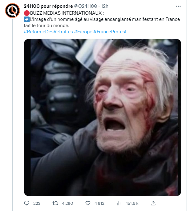 Guillaume_HB's tweet photo. Attention, l'image d'un vieil homme au visage ensanglanté pendant une manifestation a vraisemblablement été générée par une IA 👇 https://t.co/HwLJkeiMmm