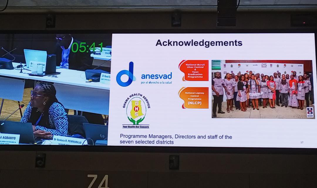 YawAmoako2002's tweet photo. @WHO first Global meeting on Skin NTDs. @AbigailAgbanyo highlights the important role of reference laboratories in the fight against skin NTDS @RichardAllanP https://t.co/J9NQVXck8u