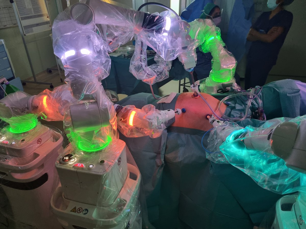 Well done to <a href="/KatParmar/">Kat Parmar</a> for being the first trainee to start live training on #Versius robot.
Thank you @alicia_silson, Kate <a href="/CMRSurgical/">CMR Surgical</a> and <a href="/MFT_MRI/">Manchester Royal Infirmary</a> for the support.
<a href="/MFTnhs/">MFT NHS</a> <a href="/bengriffiths73/">Ben Griffiths</a> <a href="/DeenaHarji/">Deena Harji</a> <a href="/Ben_Hornung/">Ben Hornung</a> <a href="/ACPGBI/">@ACPGBI</a>