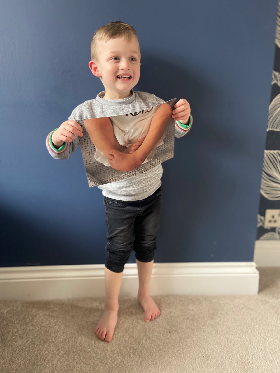 GlobalClubfoot's tweet photo. Thank you to @toddleabout for sharing our article written by #GCI's very own Natalie Eagle. It is wonderful to be able to use platforms such as Toddle About to reach parents, raise awareness of #clubfoot and let them know they are not alone. #ponsetipower

https://t.co/mwsfOEpoes https://t.co/jRQkrSUlW5