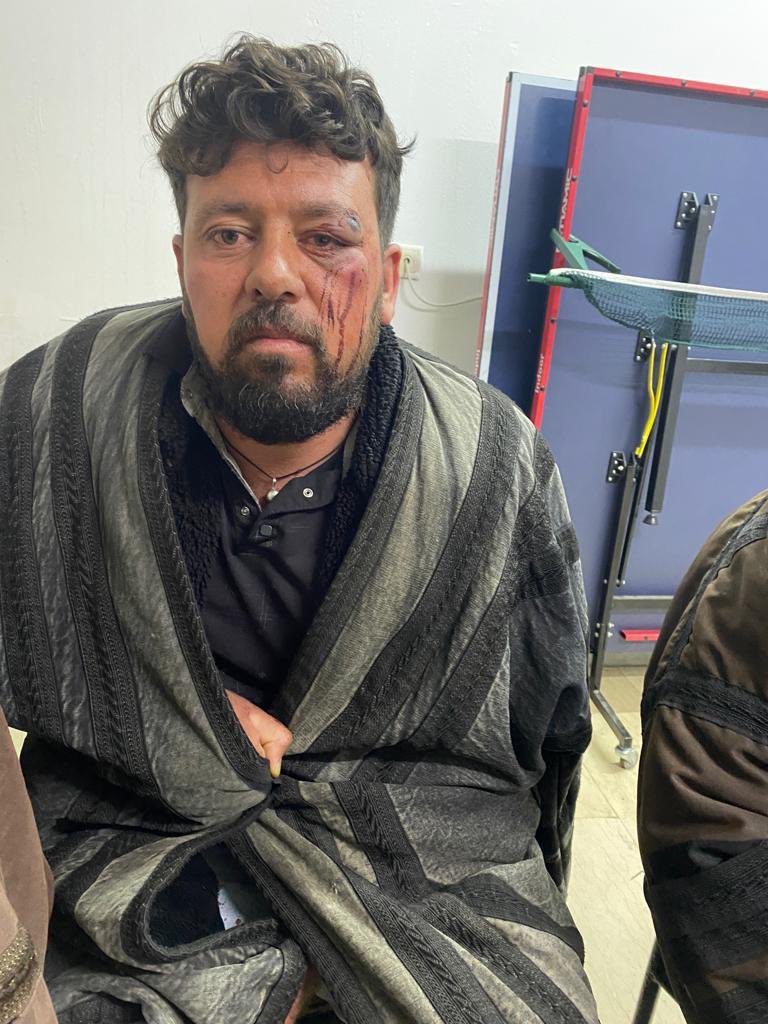 Viranşehire bağlı Kadıköy kırsal mahallesinde Ges’e tepki gösteren köylülerden bazıları gözaltına alındıktan sonra jandarma karakolunda darp edilmişlerdir.Suç işleyen kamu görevlileri hakkında suç durusunda bulunmak üzere Viranşehir adliyesindeyiz.