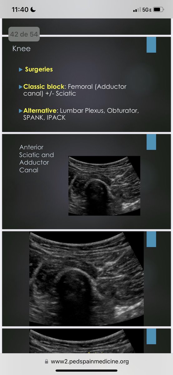 Dr Lang teaching regional blocks for ACL surgery.  Funny and engaging lecture! #SPPM2023 #pedspain