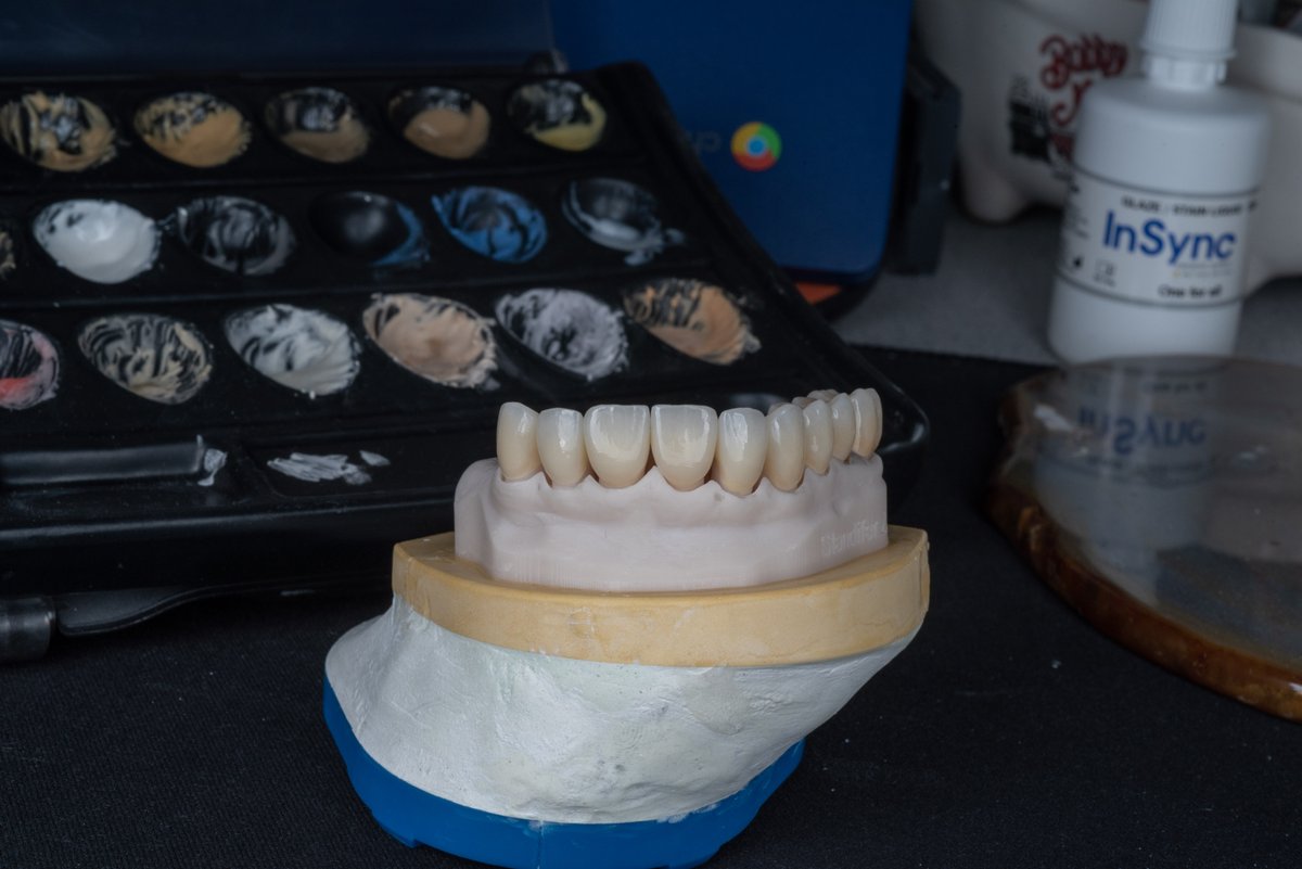 AdamRut9260's tweet photo. Check out this stunning full maxillary rehabilitation using Noritake Katana YML zirconia! Our Exocad Grand Prize winner, Issak Combria, designed the case and our expert ceramist Andres Vega finished it to perfection. #noritakekatana #exocad #cosmeticdentistry #smilemakeover https://t.co/ETZbXZQsfE