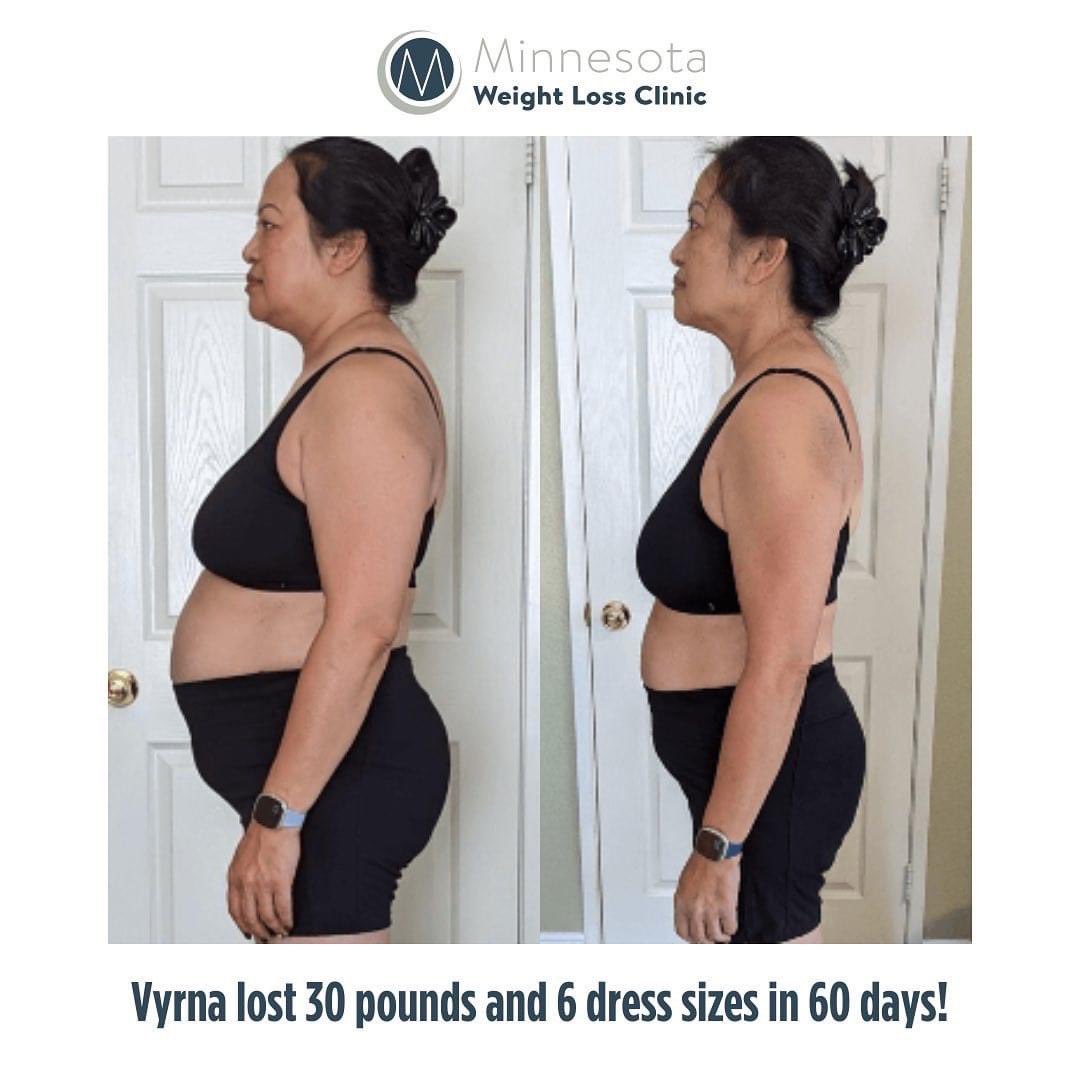 MN Weight Loss Clinic tweet media