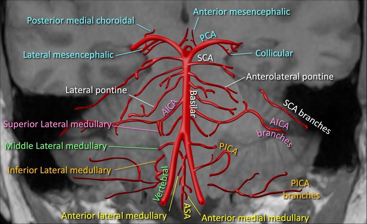 In medicine, anatomy is power. It helps diagnose &amp; treat disease--but you must know it first!

Posterior fossa perforator branches are key in #stroke. How many do you know?

Here's a color coded map of perforators from each vessel,to help you branch out!
#medtwitter #meded #neuro
