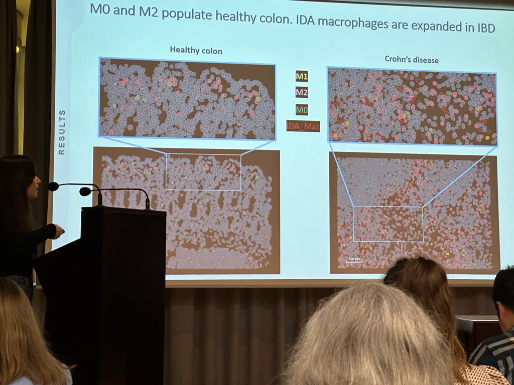 ibd_bcn's tweet photo. @microalba just presented her groundbreaking work on macrophage and neutrophil heterogeneity in IBD at the Single-Cell Genomics conference in Barcelona. Using single-cell spatial resolution, we're gaining new insights into this complex disease. #SingleCell https://t.co/Y3jxTkDTIQ