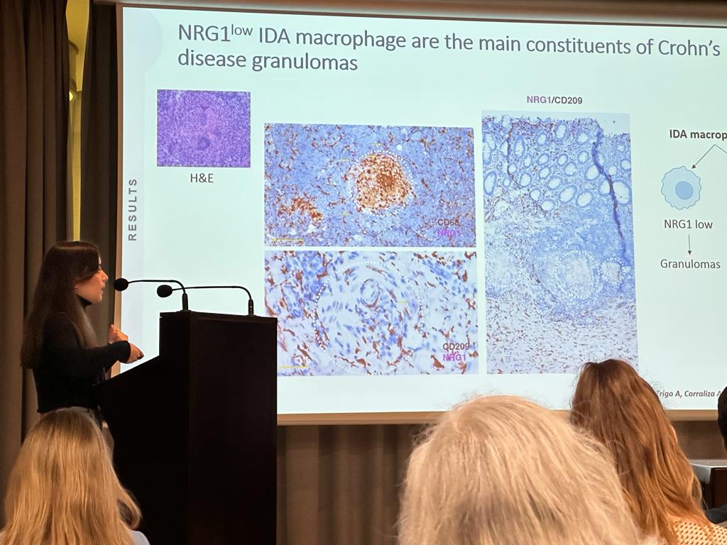 ibd_bcn's tweet photo. @microalba just presented her groundbreaking work on macrophage and neutrophil heterogeneity in IBD at the Single-Cell Genomics conference in Barcelona. Using single-cell spatial resolution, we're gaining new insights into this complex disease. #SingleCell https://t.co/Y3jxTkDTIQ