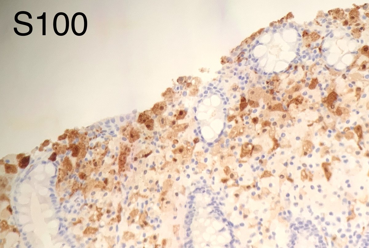 Austin McHenry, MD tweet media