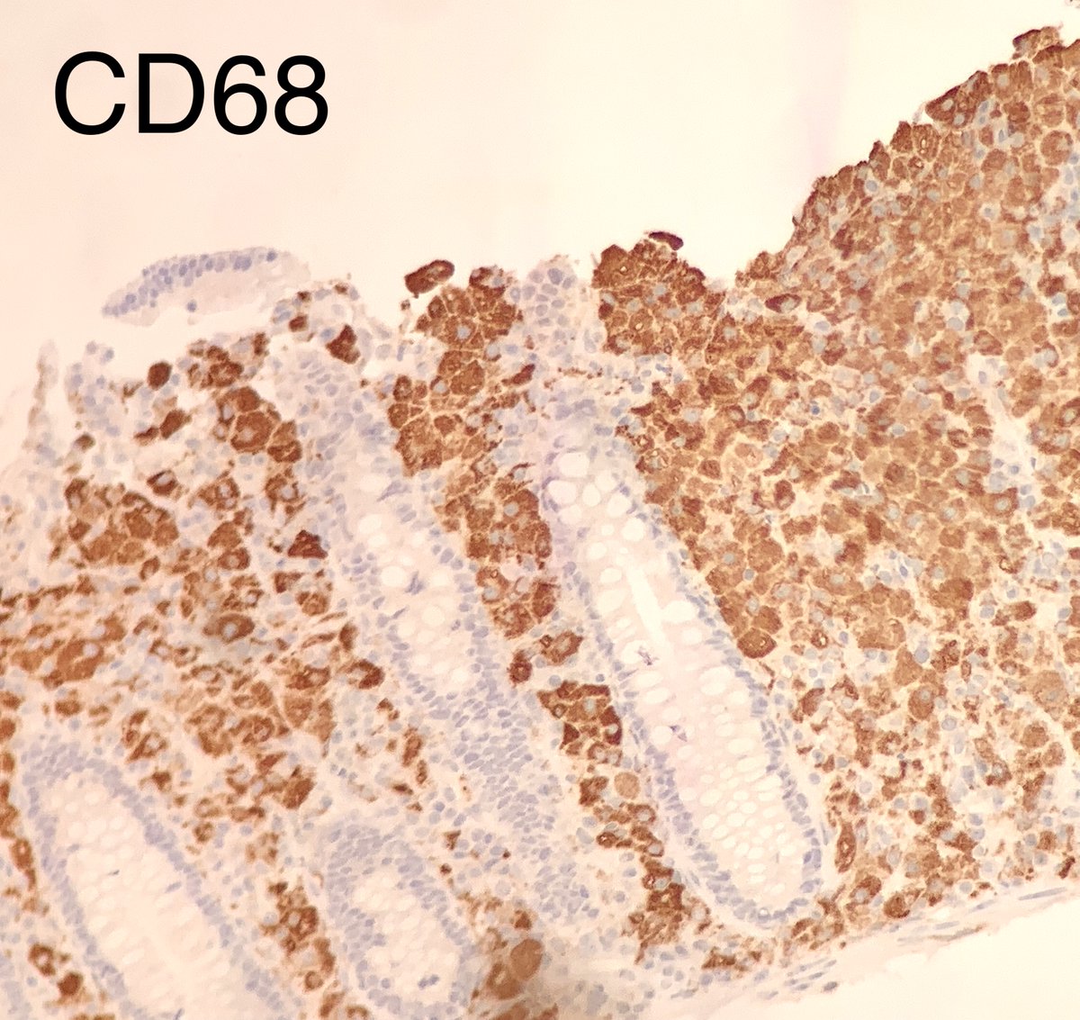 Austin McHenry, MD tweet media