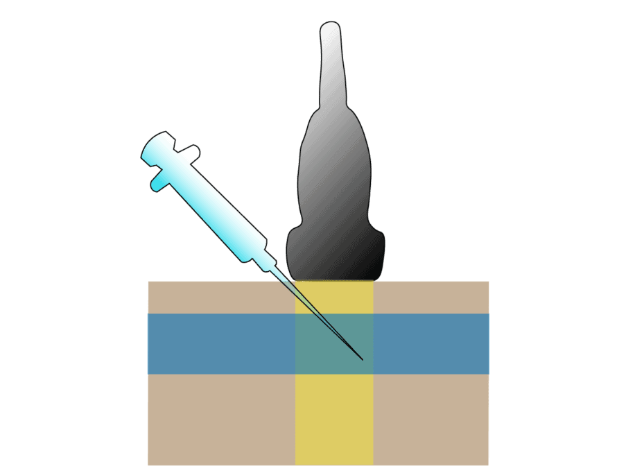 POCUS 101 tweet media