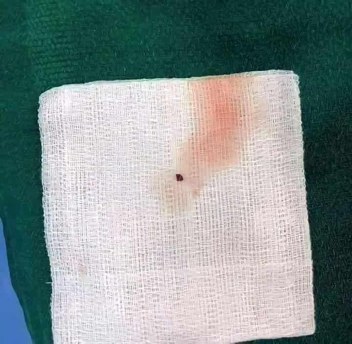 يا أيها الإنسان ما غرك بربك الكريم ..!

هذه النقطة المتناهية الصغر التي تراها أمامك الآن هي جلطة ازالها فريق طبي من شريان رئيسي يغذي منطقة اساسية بالمخ ..

هذه النقطة كانت كفيلة بأن يمضي صاحبها بقية حياته اما مشلولاً على فراشه أو مدفوناً تحت الارض ..

هذه النقطة كفيلة بأن تقضي