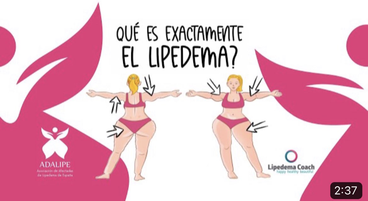 ADALIPE - asociación de lipedema de españa tweet media