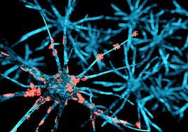 Gene Therapy (@genetherapy_sn) on Twitter photo Trending now, #intrathecal injection of #AAV9-mediated HGF #genedelivery reduces astrogliosis in the motor cortex of #ALS animal models. For more, join our #GTReaders here now➡️nature.com/articles/s4143…
Work by <a href="/NorthwesternU/">Northwestern</a> Helixmith Co. & @SNUnow
📸: ©iStock Trending now, #intrathecal injection of #AAV9-mediated HGF #genedelivery reduces astrogliosis in the motor cortex of #ALS animal models. For more, join our #GTReaders here now➡️nature.com/articles/s4143…
Work by <a href="/NorthwesternU/">Northwestern</a> Helixmith Co. & @SNUnow
📸: ©iStock