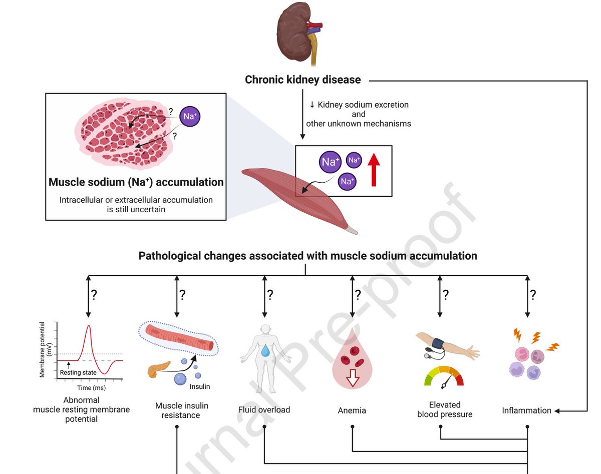 New article on #muscle sodium accumulation in #kidney failure jrnjournal.org/article/S1051-… #RenalNutrition