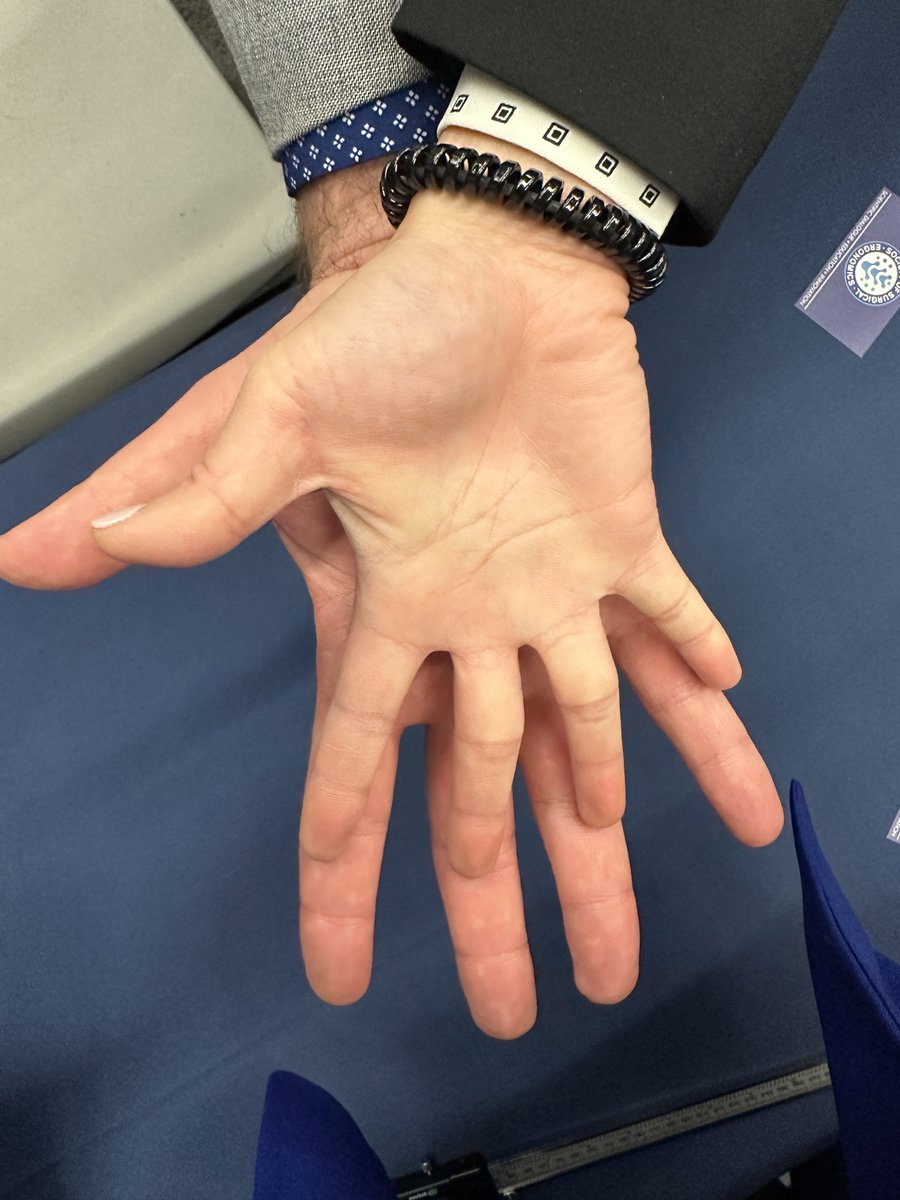Surgical instrumentation shouldn’t be one size fits all These are surgeons with 5.5 and 8.5 glove-size hands from SAGES. Thanks to your participation at our booth 303