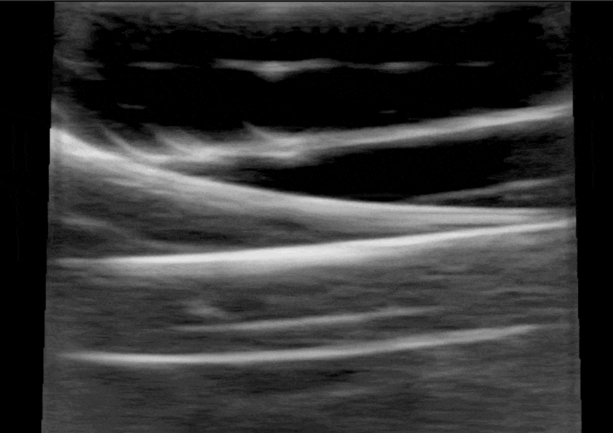 POCUS 101 tweet media