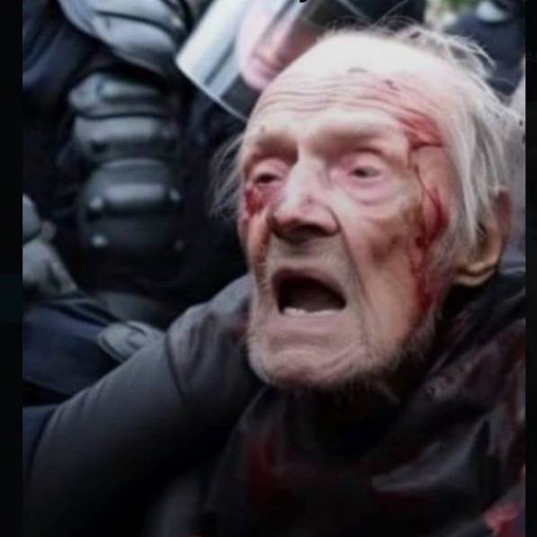 vl_plus's tweet photo. Images vidéo et photo de l'homme âgé ensanglanté lors de la manifestation contre la Réforme des Retraites  
🔸 Son portrait fait le tour du monde.
🔸 Traîné, menotté.

Voilà le vrai visage de la violence gouvernementale ! https://t.co/KZBcWGt1O6
