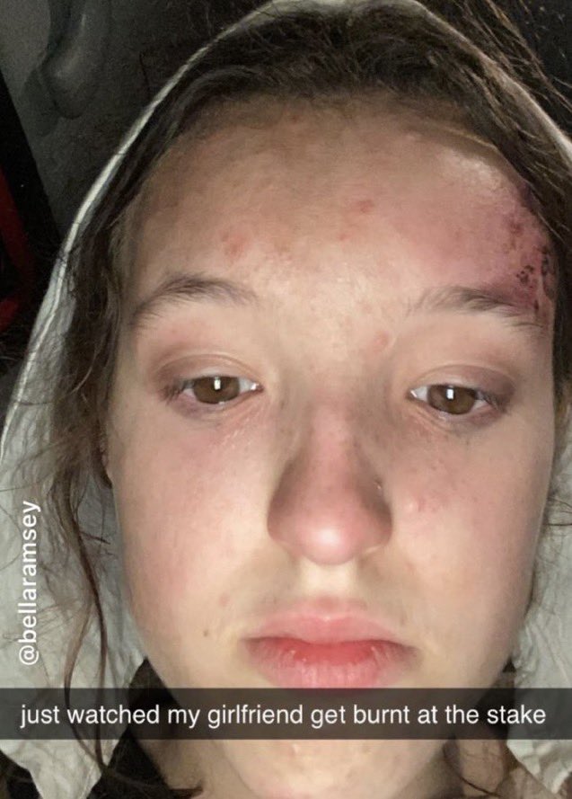 sllashers's tweet photo. tara when amber got her face roasted https://t.co/PutiJgI8Y3