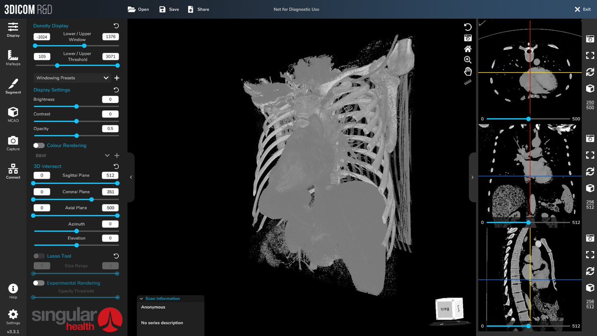 💡 DID YOU KNOW?

Part of our Version 3.3 update includes a New Colour Rendering Editor

This exciting feature will be able to assist users: 

✅ With the ability to select preset colours

✅ Customise your own colour presets

✅ and more!

📌 3dicomviewer.com