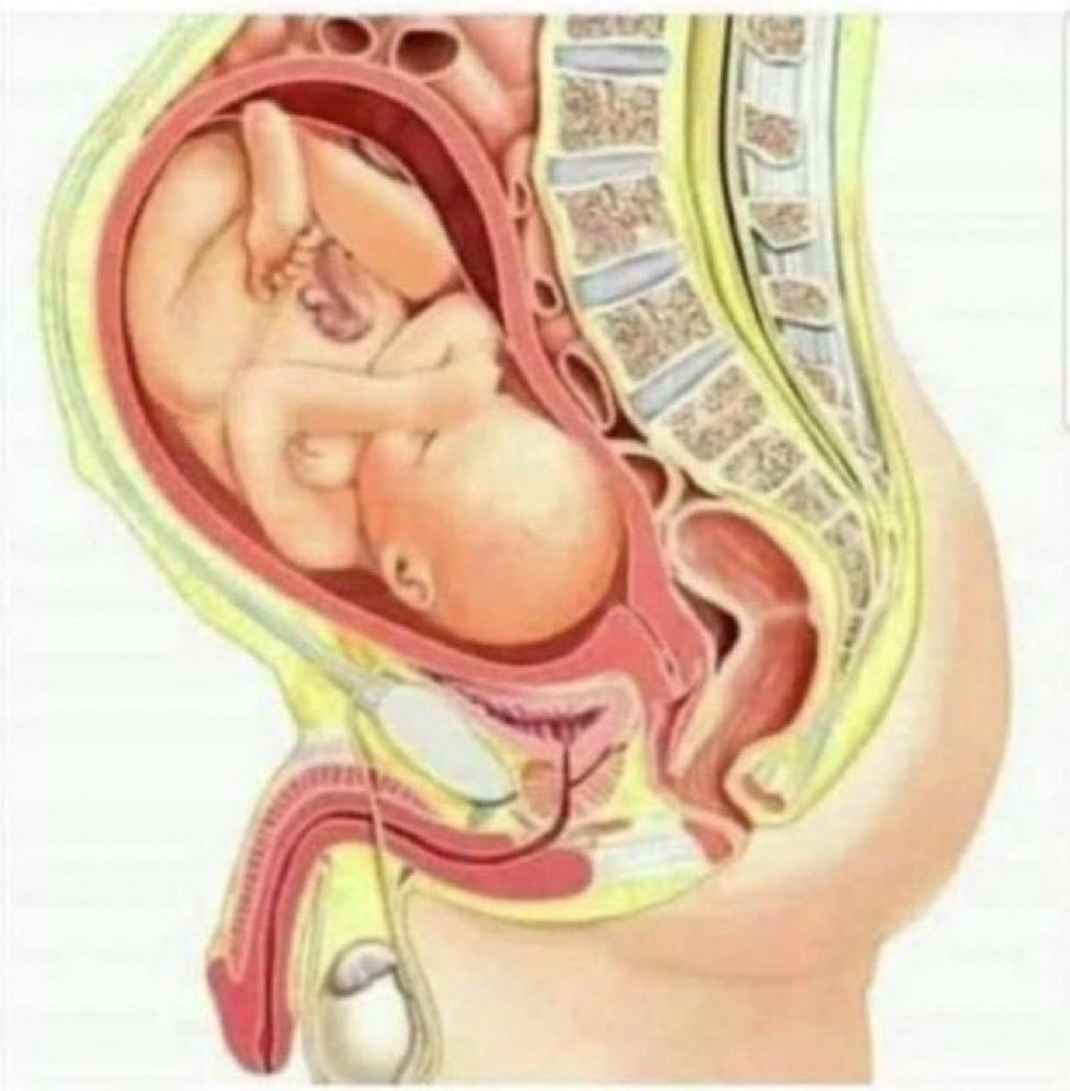 alphafox's tweet photo. Where does the baby exit the transvestite reproductive system? https://t.co/l0syswn5y1