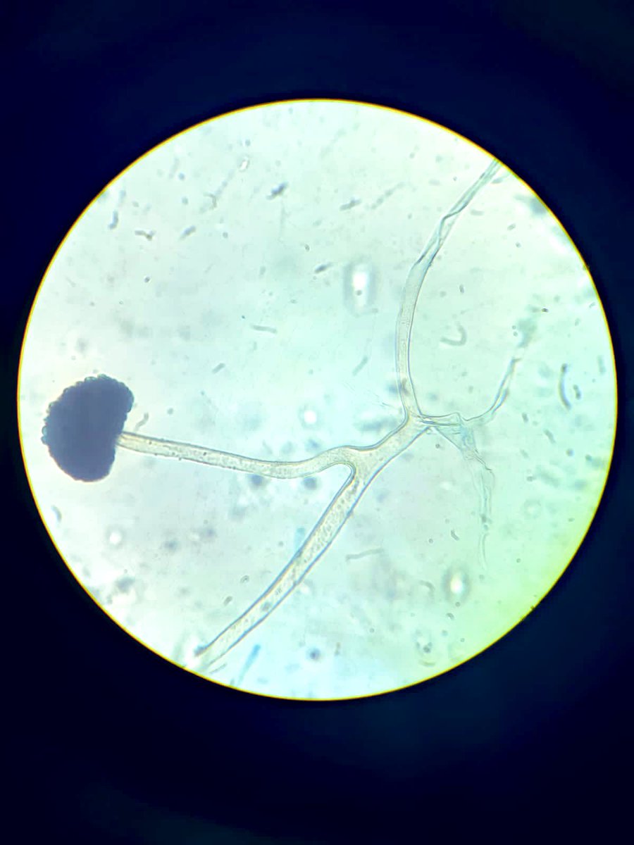 Rhizomucor 🍄 #Infectology #Microbiology