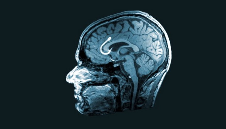 Se habla de una epidemia de "#aprendizaje basura", cuyos síntomas son:
1. Falso aprendizaje
2. Pérdida de memoria
3. FOMO
4. Adición y distracción constante
5. Desconexión de la realidad
6. Sobre cofianza

buff.ly/3akrBog 

#contenido #productividad